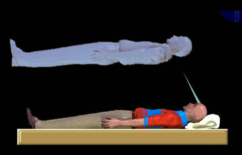 Artist's depiction of the separation stage of an out-of-body experience, which often precedes free movement