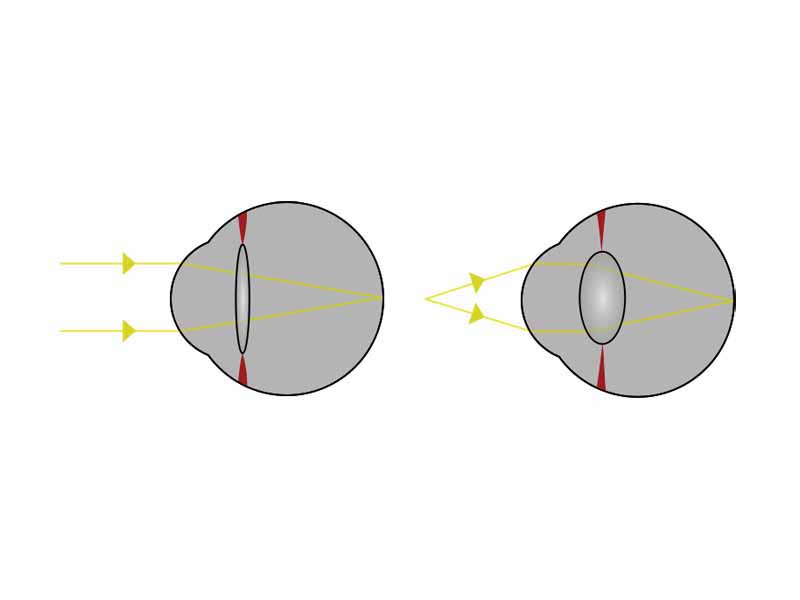 Light from a single point of a distant object and light from a single point of a near object being brought to a focus by changing the curvature of the lens.