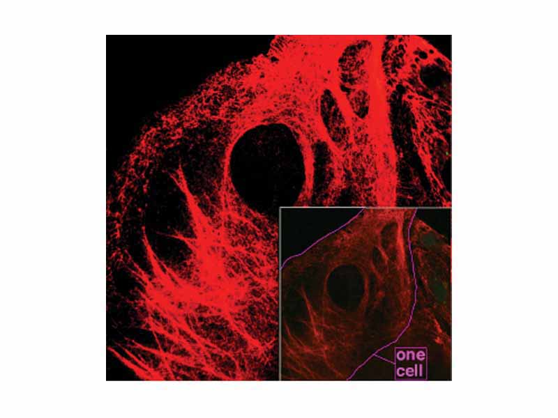 Microscopy of keratin filaments inside cells.
