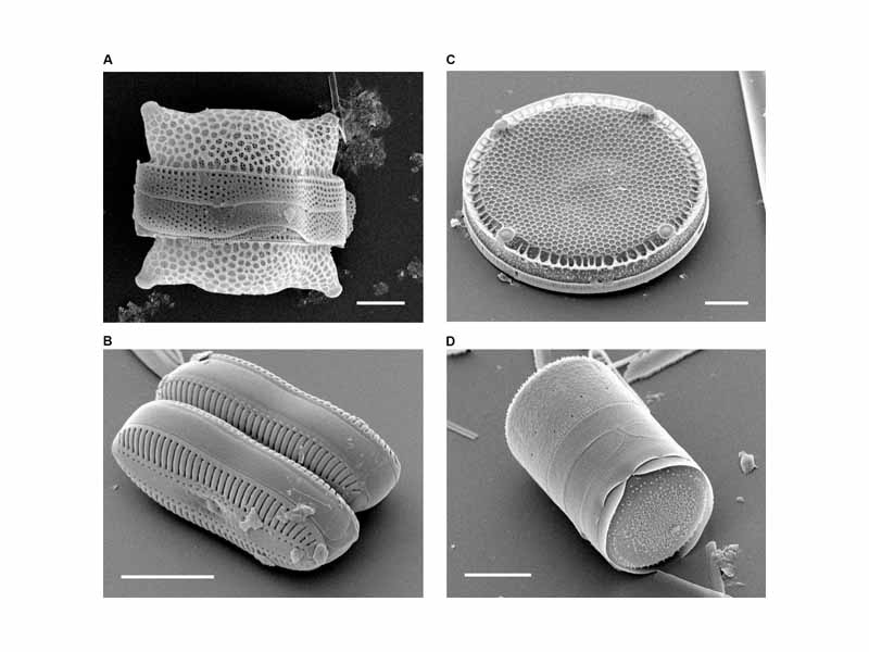 Scanning Electron micrographs of diatoms showing the external appearance of the cell wall
