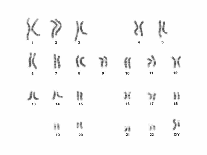 A karyotype of a human male, showing 46 chromosomes including XY sex chromosomes.