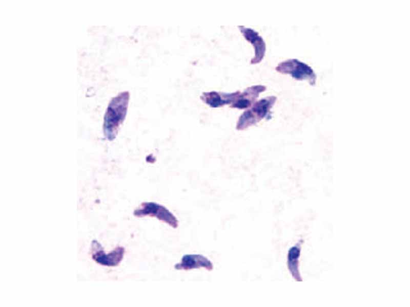 Toxoplasma gondii tachyzoites, stained with Giemsa, from a smear of peritoneal fluid obtained from a mouse inoculated with T. gondii. Tachyzoites are typically crescent shaped with a prominent, centrally placed nucleus.