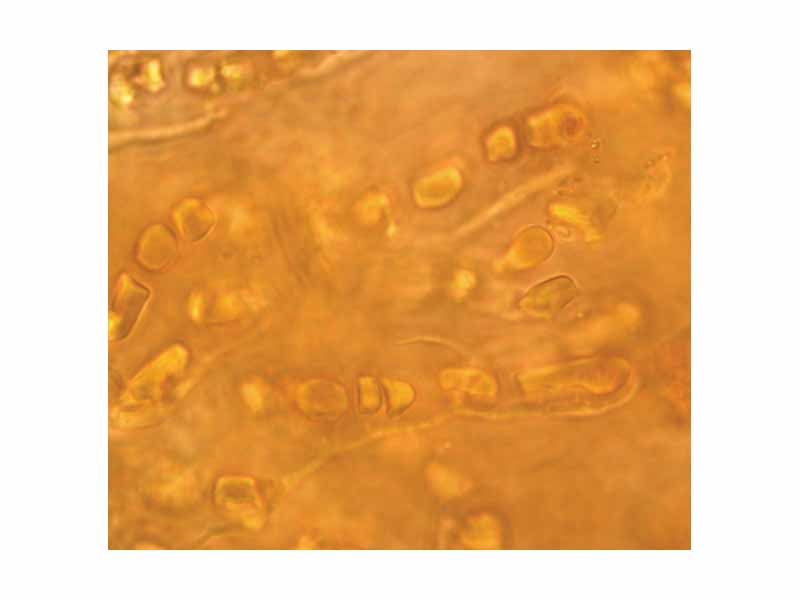 The cyanobacterium Hyella caespitosa with fungal hyphae in the lichen Pyrenocollema halodytes