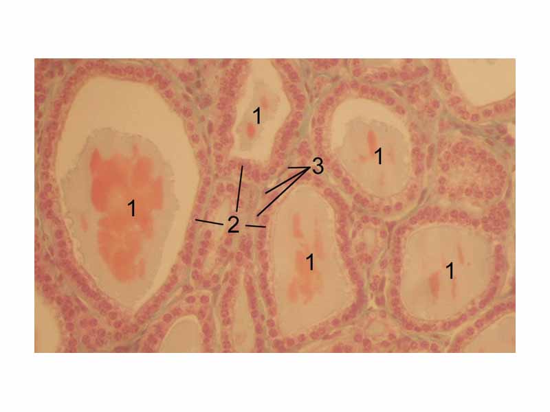 Histological section through the thyroid of a horse. 1 follicles, 2 follicular epithelial cells, 3 endothelial cells