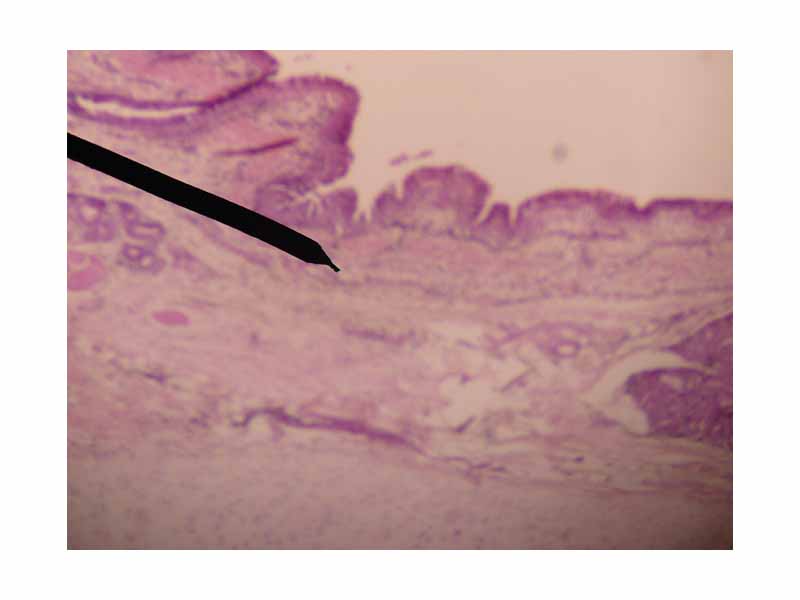 Microscopic cross section of human trachea.