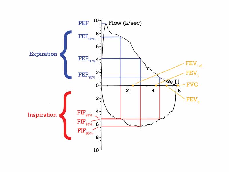 Flow-Volume loop showing successful FVC maneuver. Positive values represent expiration, negative values represent inspiration. The trace moves clockwise for expiration followed by inspiration. (Note the FEV1, FEV1/2 and FEV3 values are arbitrary in this graph and just shown for illustrative purposes, they must be recorded as part of the experiment).