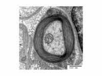 Transmission electron micrograph of a...