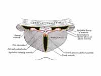 Coronal section of lateral and third ...